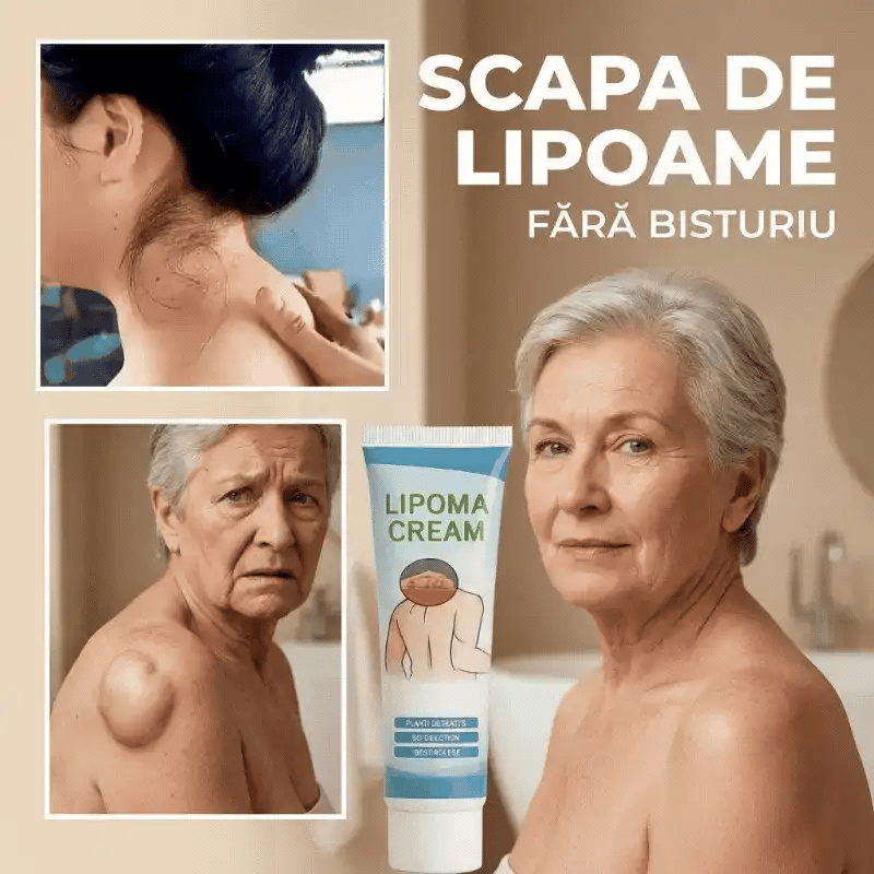 1+1 GRATIS – Cremă pentru eliminarea lipoamelor
