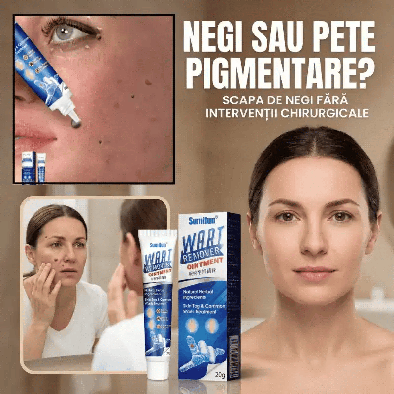 1+1 GRATIS - Crema pentru indepartarea negilor & petelor pigmentate