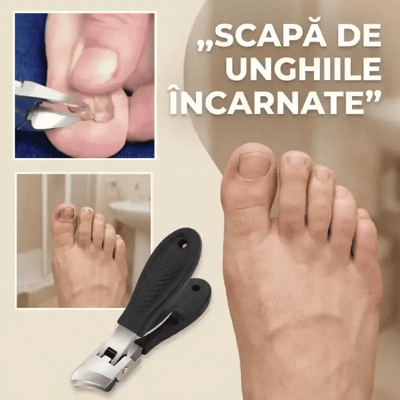 Unghiera pentru unghii incarnate